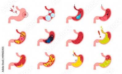 Stomach symptoms icon collection .Different organ diseases and conditions medical signs. Internal tract flat set.